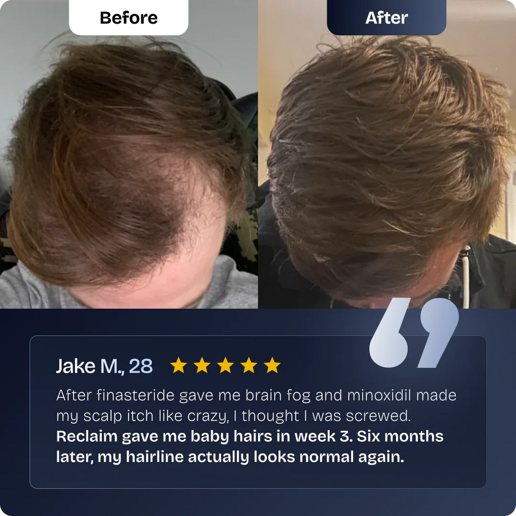 Hoegoa Hair Reawaken Roll-On Serum